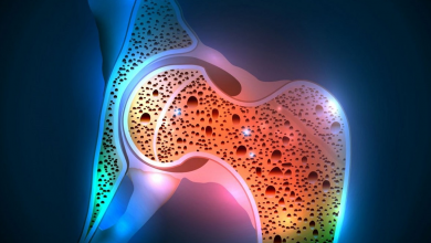 Kemik Erimesini Önlemenin Yolları Nelerdir