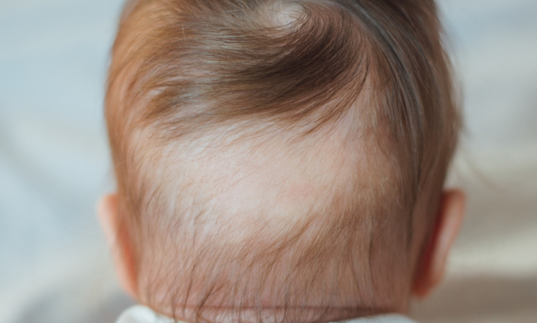 Yenidoğan Bebeklerde Saç Dökülmesi Nedenleri